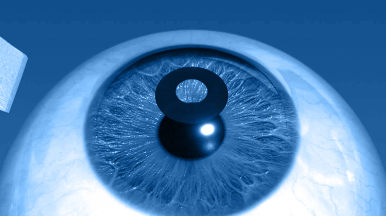Corneal Inlays Garnering Attention – and Investment - Eye On Innovation Article - Healthegy