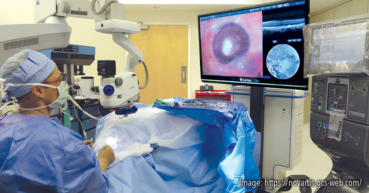 Alcon-TrueVision Partnership Delivers on Heads-Up Surgery