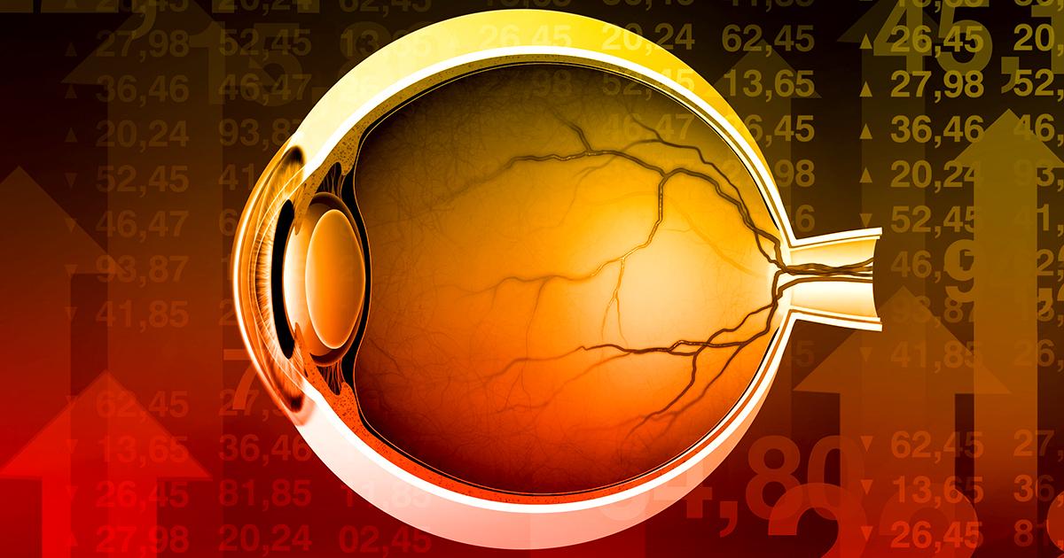 As Retina Innovators Look Outside US for Funding, Here’s What to Watch Out For