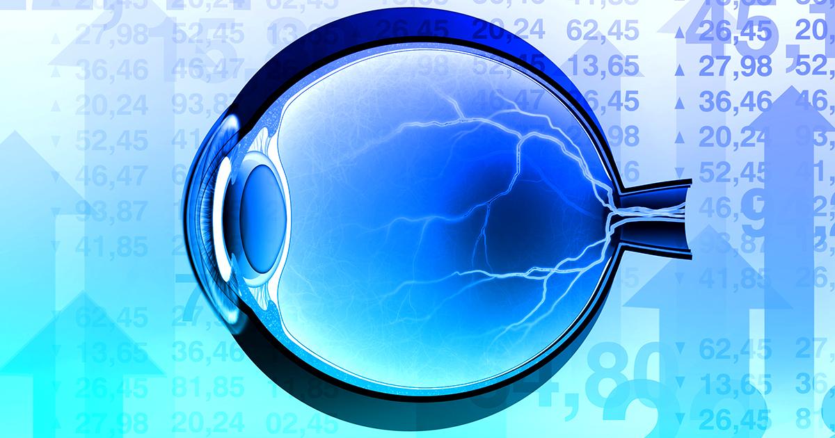 5 Factors for Evaluating Investments in the Retina Space